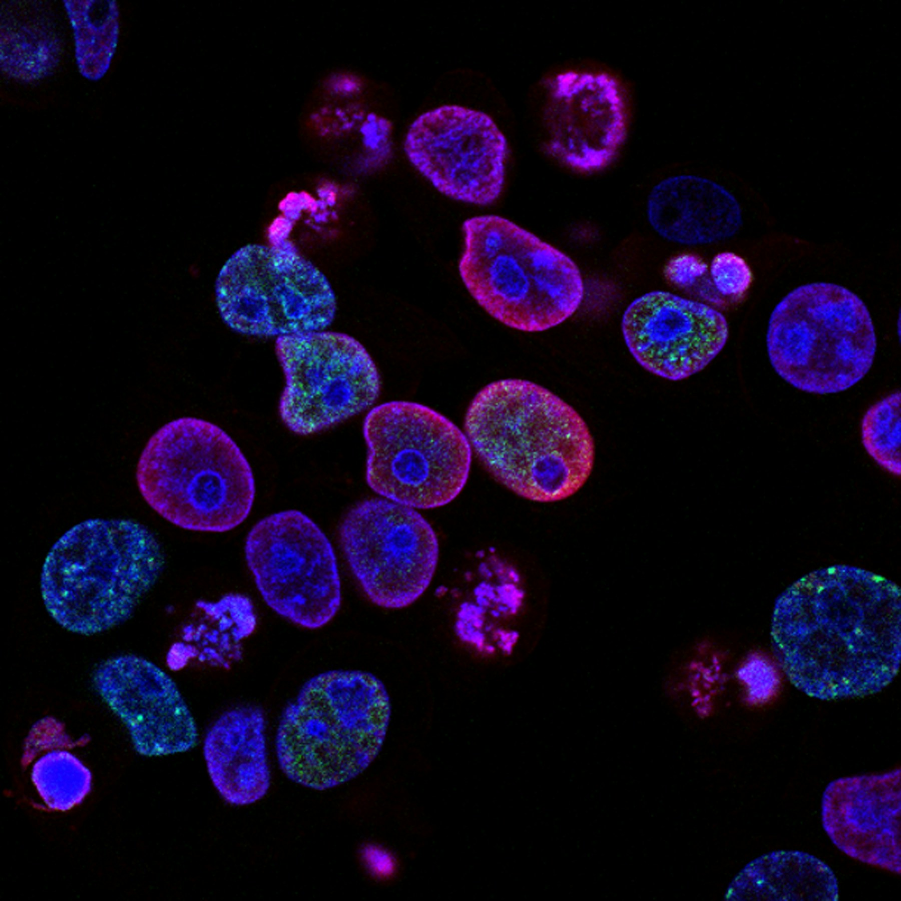 Microbial analysis designed for product safety, quality & regulatory assurance